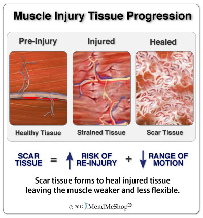 How long does it take a strained muscle to heal?